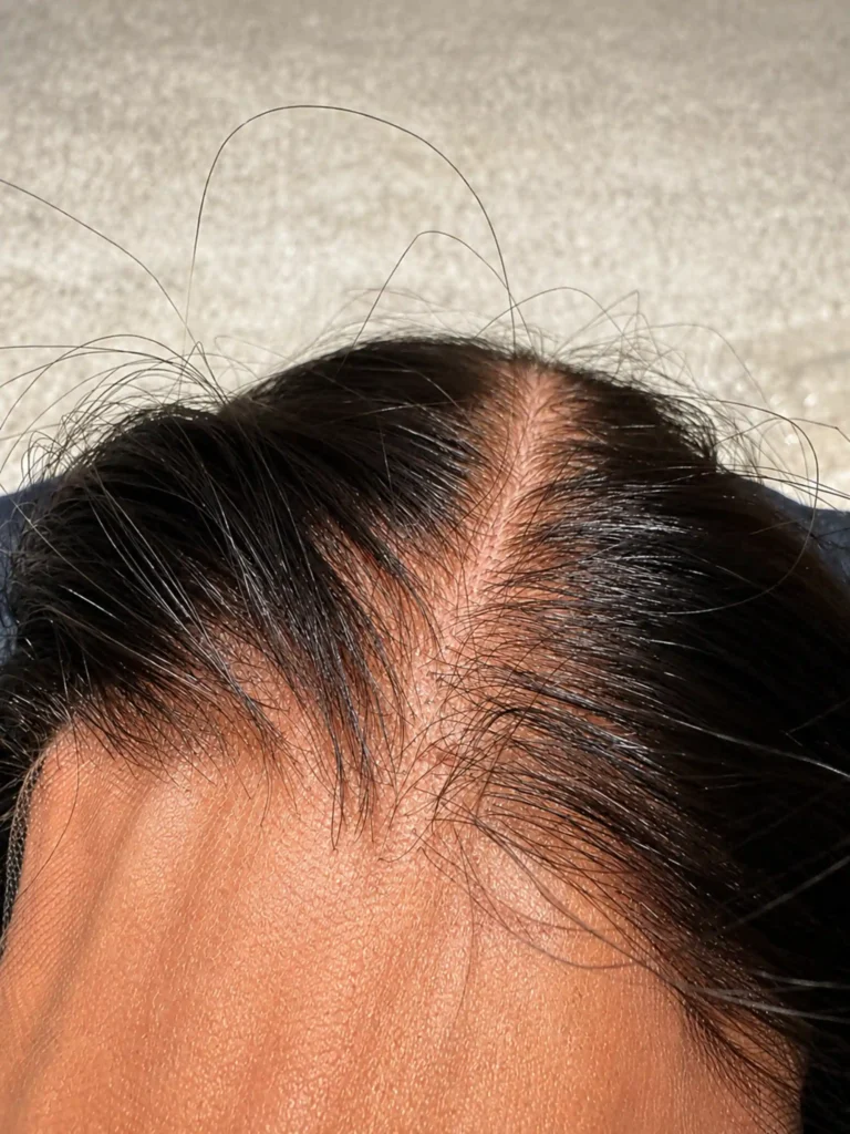 Laces Heloísa Penteado